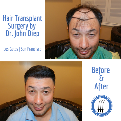 Hair Replacement Service «Medical Hair Transplant & Aesthetics», reviews and photos, 490 Post St #1701, San Francisco, CA 94102, USA