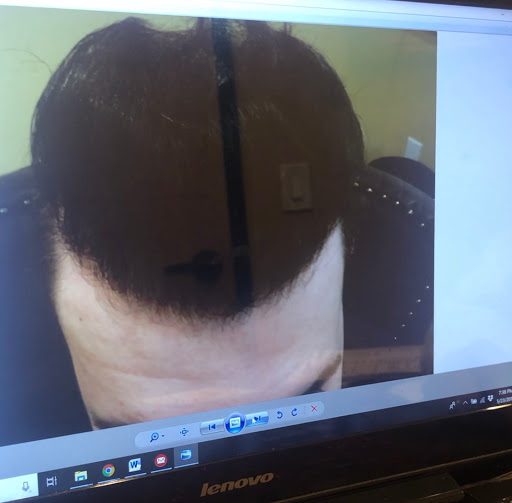 Hair Replacement Service «Medical Hair Transplants & Aesthetics», reviews and photos, 15055 Los Gatos Blvd Suite #110, Los Gatos, CA 95032, USA