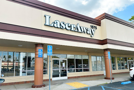 Explore ways tattoo ideas, creative tattoo ideas in Fullerton, available at LaserAway