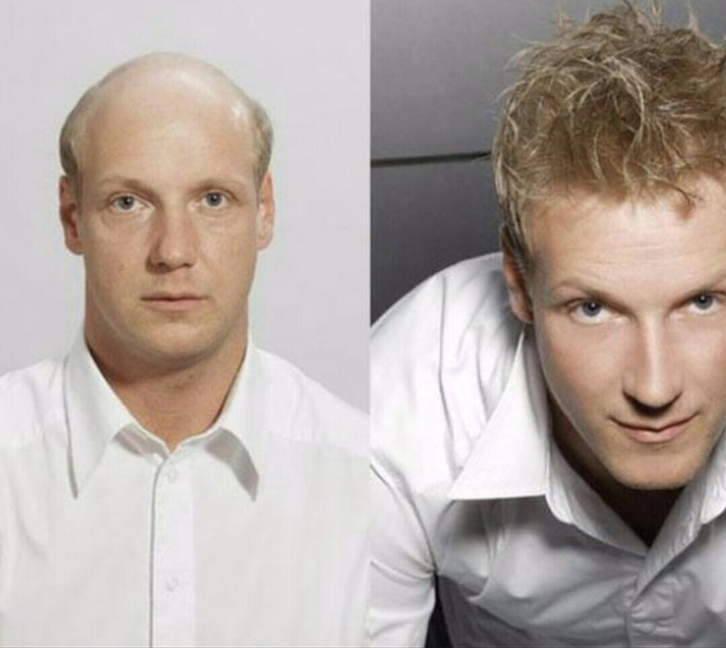 Wayne's Concept Hair Replacement 43207