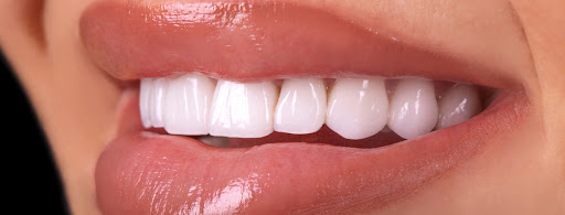 المهيدب لطب الاسنان حائل 