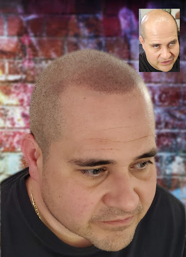 Downey Hair Loss Solutions SMP image