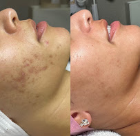 Purabelle - Photo 8 - Car repair in Quincy, MA, Quincy