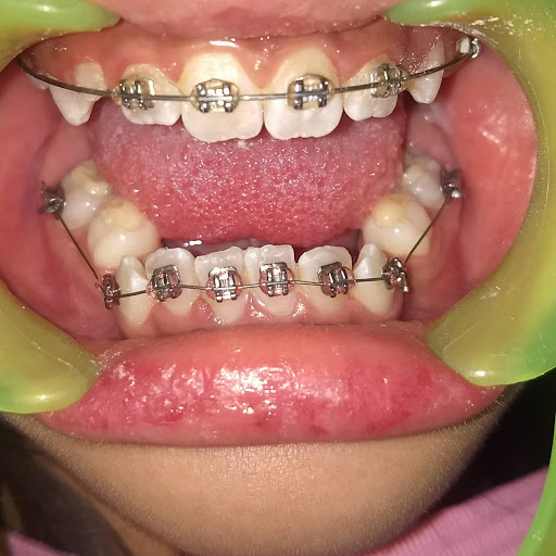 Dental C-fipar. (Ortodoncia- Brackets) Óptica y Médico Diabetologo