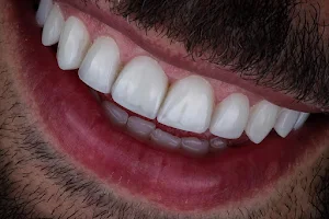 Dr. Diego Aud - Dentista/Prótese Dentaria/Facetas image