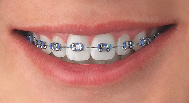 Teléfono de Clínica Dental MiO Brackets Montevideo