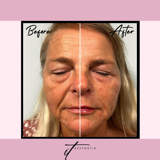 Find tattoo ideas for zodiac signs for your next unique tattoo in East Brunswick at It Aesthetix