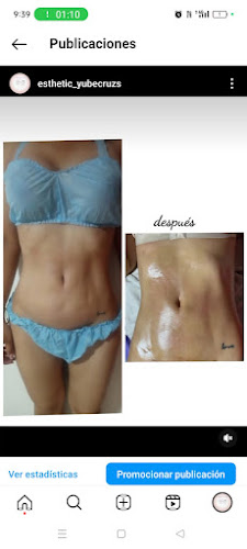 Yube Cruz Estetica y Spa - Santa Sofía