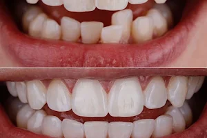 Juneja dental clinic and Implant centre image