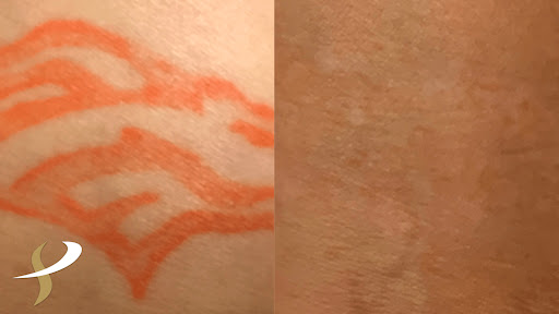 Explore cute bee tattoo ideas, creative tattoo ideas in Spokane, available at Premier Body and Laser