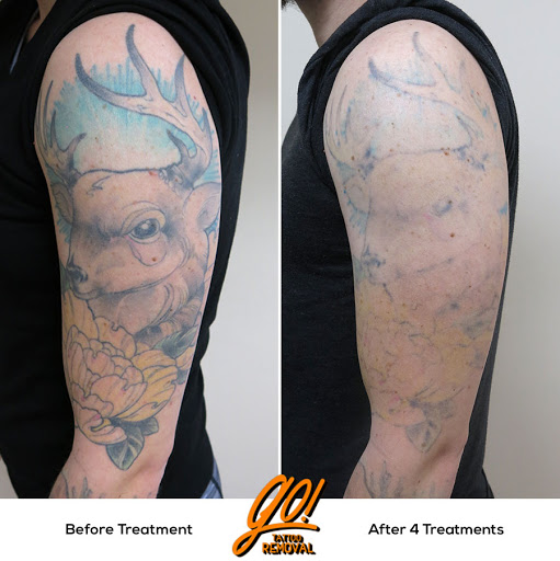 Explore nashville tattoo ideas, creative tattoo ideas in Allentown, available at Removery Tattoo Removal & Fading