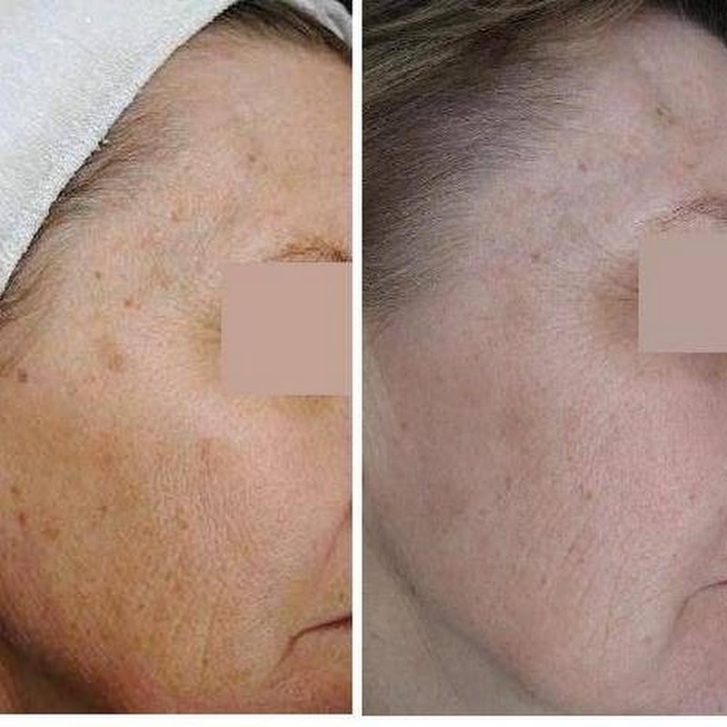 Dermal Dimensions Skin Therapy