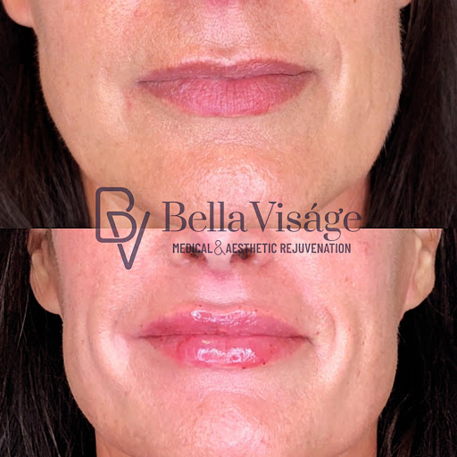 Explore ninja tattoo ideas, creative tattoo ideas in Lakeland, available at Bella Visge Medical & Aesthetic Rejuvenation