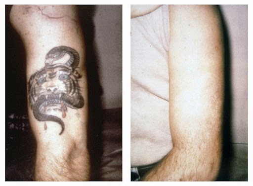 Explore small grandparents tattoo ideas, creative tattoo ideas in Colleyville, available at DFW Tattoo Removal