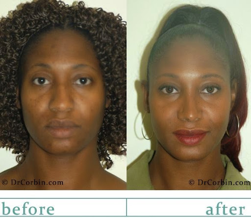 Dr. Corbin Plastic Surgery image