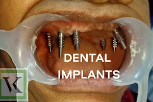 VK DENTAL AND FACIAL AESTHETICS CLINIC IMPLANTS AND LASERS image