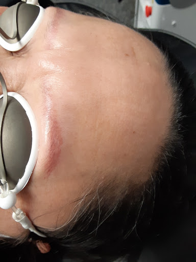 Explore arm florida tattoo ideas, creative tattoo ideas in Saint Paul, available at Fearless Tattoo Removal