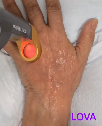 Explore complex tattoo ideas, creative tattoo ideas in Lake Oswego, available at Lake Oswego Vein and Aesthetic LOVA