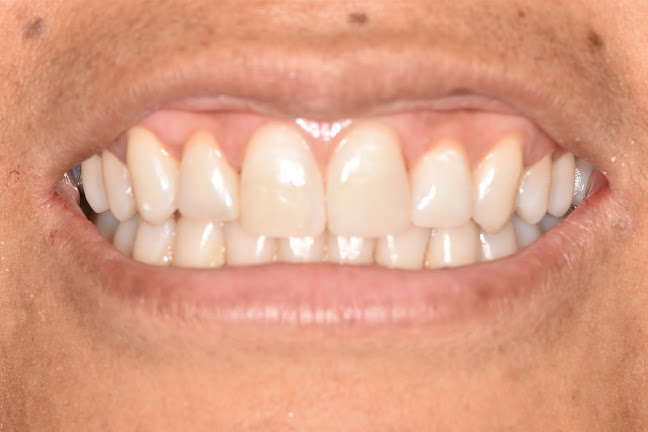 Opiniones de Centro Odontológico CODAVIDA PUNO en Puno - Dentista
