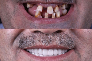 Clínica Odontológica Lacoste & Montaña image