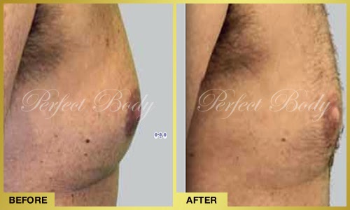 Explore anime leg tattoo ideas, creative tattoo ideas in Bay Shore, available at Perfect Body Laser & Aesthetics