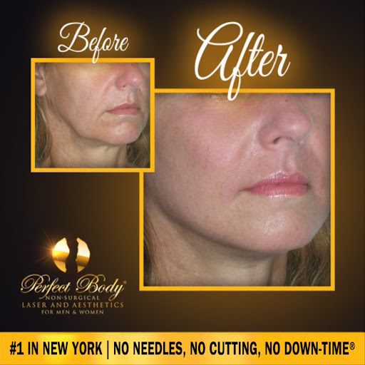 Explore tokyo revengers tattoo ideas, creative tattoo ideas in Bay Shore, available at Perfect Body Laser & Aesthetics