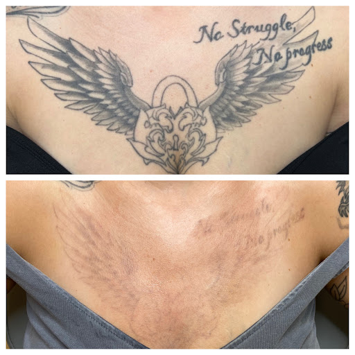 Explore submarine tattoo ideas, creative tattoo ideas in Pittsburgh, available at Goodbye Rhonda - Laser Tattoo Removal