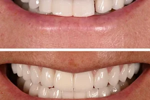 Michael Han Implant and Cosmetic Dentistry image