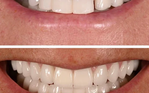 Michael Han Implant and Cosmetic Dentistry image