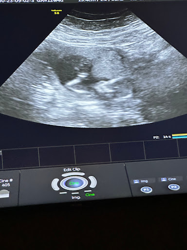 A Little Insight 3D 4D 5D Ultrasound image