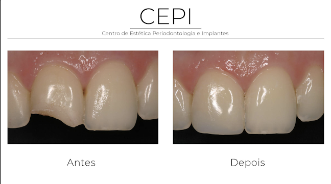Comentários e avaliações sobre o Centro de Estética Periodontologia e Implantes (CEPI) RFA Medicina Dentária Lda
