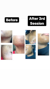 Simply Flawless Electrolysis - Photo 4 - Car repair in Newport News, VA, Newport News