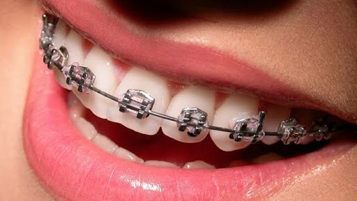 Krishna Dental Care Orthodontic & implant centre-Best dentist in jaipur