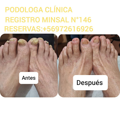 Podología clínica a domicilio