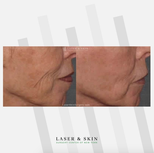 Find good vs evil tattoo ideas for your next unique tattoo in Southampton at Laser & Skin Surgery Center of New York - Southampton