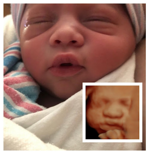 A Little Insight 3D 4D 5D Ultrasound image