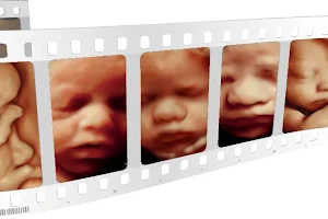 4D Love at First Sight 3D Ultrasound Jasper image