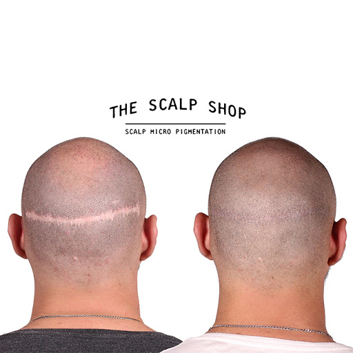 The Scalp Shop