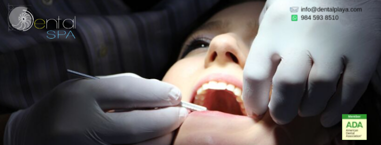 مركز بلايا لطب الأسنان - Playa Dental Center