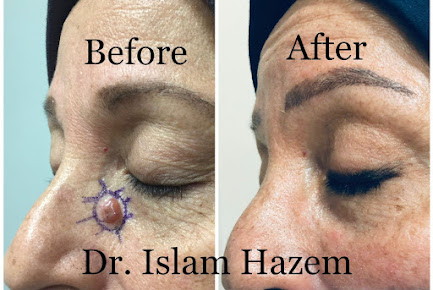 Dr. Hazem Mokhaimer - Dr. Hazem Mokhaimer