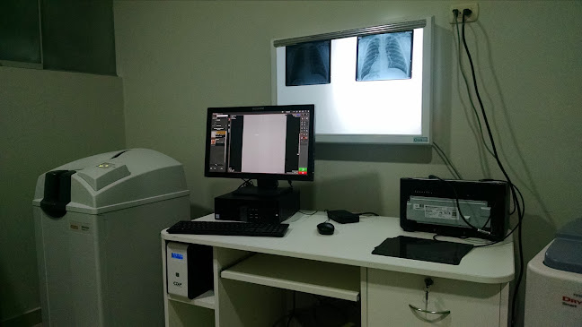 Opiniones de Centro de diagnóstico por imagen R&G AMBO en Huánuco - Hospital
