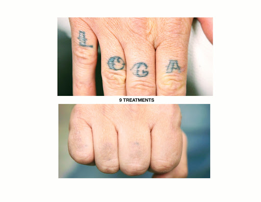 Explore mamba mentality tattoo ideas, creative tattoo ideas in Chino, available at SoCal Body Institute