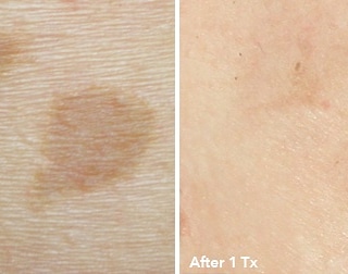 Explore acoustic guitar tattoo ideas, creative tattoo ideas in Glenwood Springs, available at Lifestyle Laser