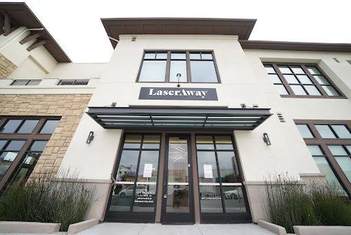 Explore foot print tattoo ideas, creative tattoo ideas in San Carlos, available at LaserAway