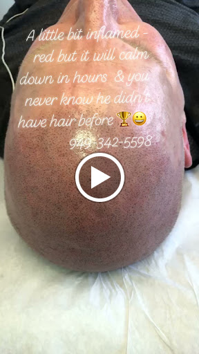 SMP Hair Clinic The Queen Of Scalp image