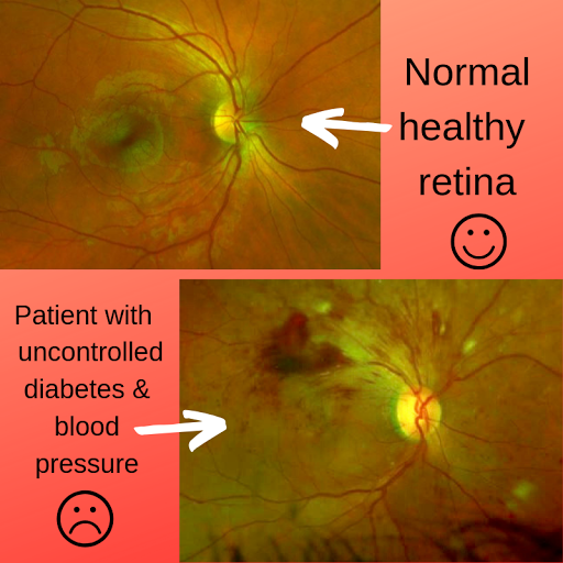 Optometrist «Vision Source-Orland Park», reviews and photos, 9031 W 151st St, Orland Park, IL 60462, USA