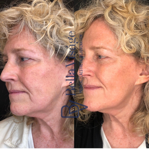 Explore girly hand tattoos ideas, creative tattoo ideas in Lakeland, available at Bella Visge Medical & Aesthetic Rejuvenation