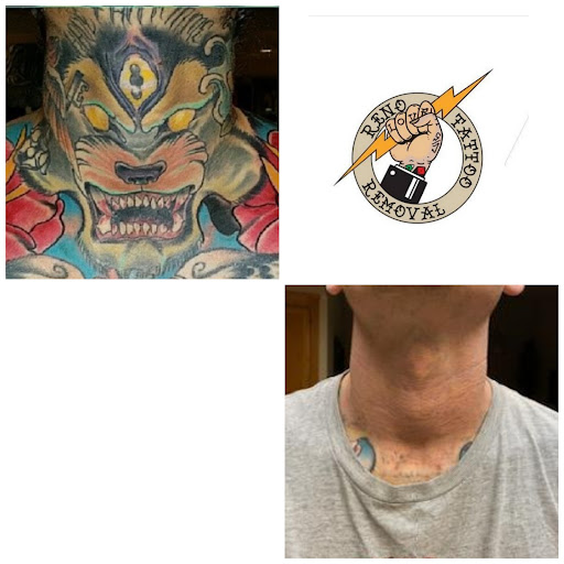 Explore multiple name tattoo ideas, creative tattoo ideas in Reno, available at Reno Tattoo Removal