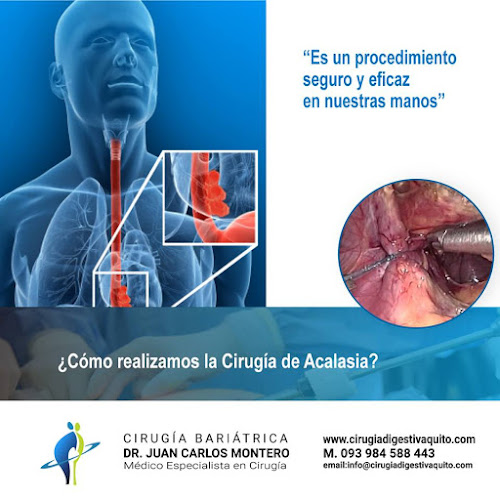 Dr. Juan Carlos Montero - Cirugía Bariátrica y Digestiva - Quito