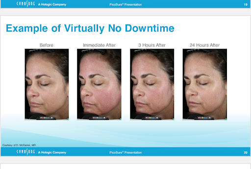 Explore hand tattoo ideas female, creative tattoo ideas in New York, available at Ag2g Laser Tattoo Removal & MedSpa